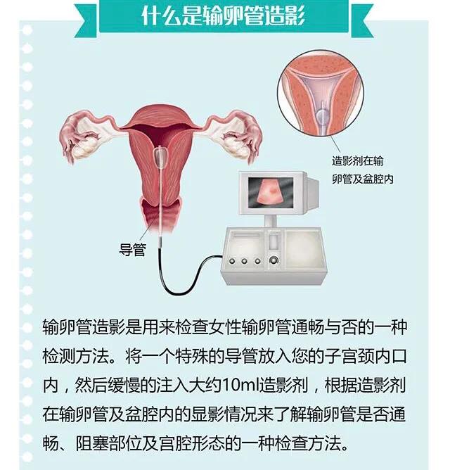 宫外孕早期保守治疗好还是手术好,怀孕初期预防宫外孕的运动锻炼