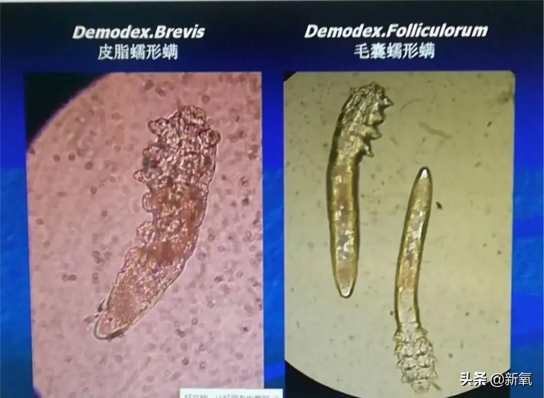 宋祖儿港风绝美照片,宋祖儿侧颜简直太美啦