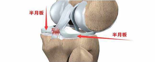 爬楼梯膝盖骨关节疼怎么办,爬楼梯爬到膝盖疼怎么办