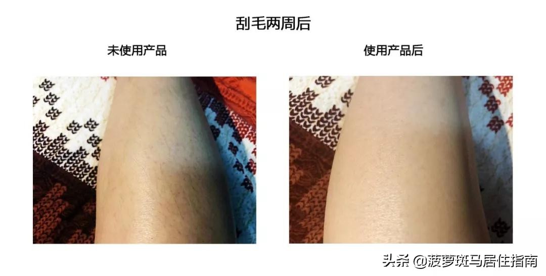 脱毛方法大盘点,脱毛攻略不要广告