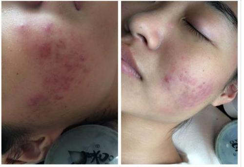 皮肤暗黄无光泽一招教你快速改善,怎么解决皮肤粗糙无光泽