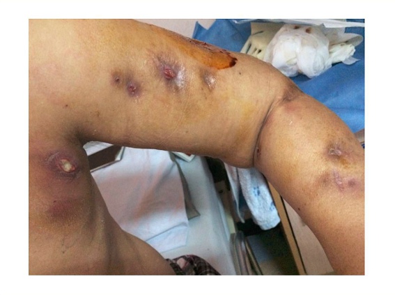 把胳膊砍掉疼不疼,医生能不能帮帮我