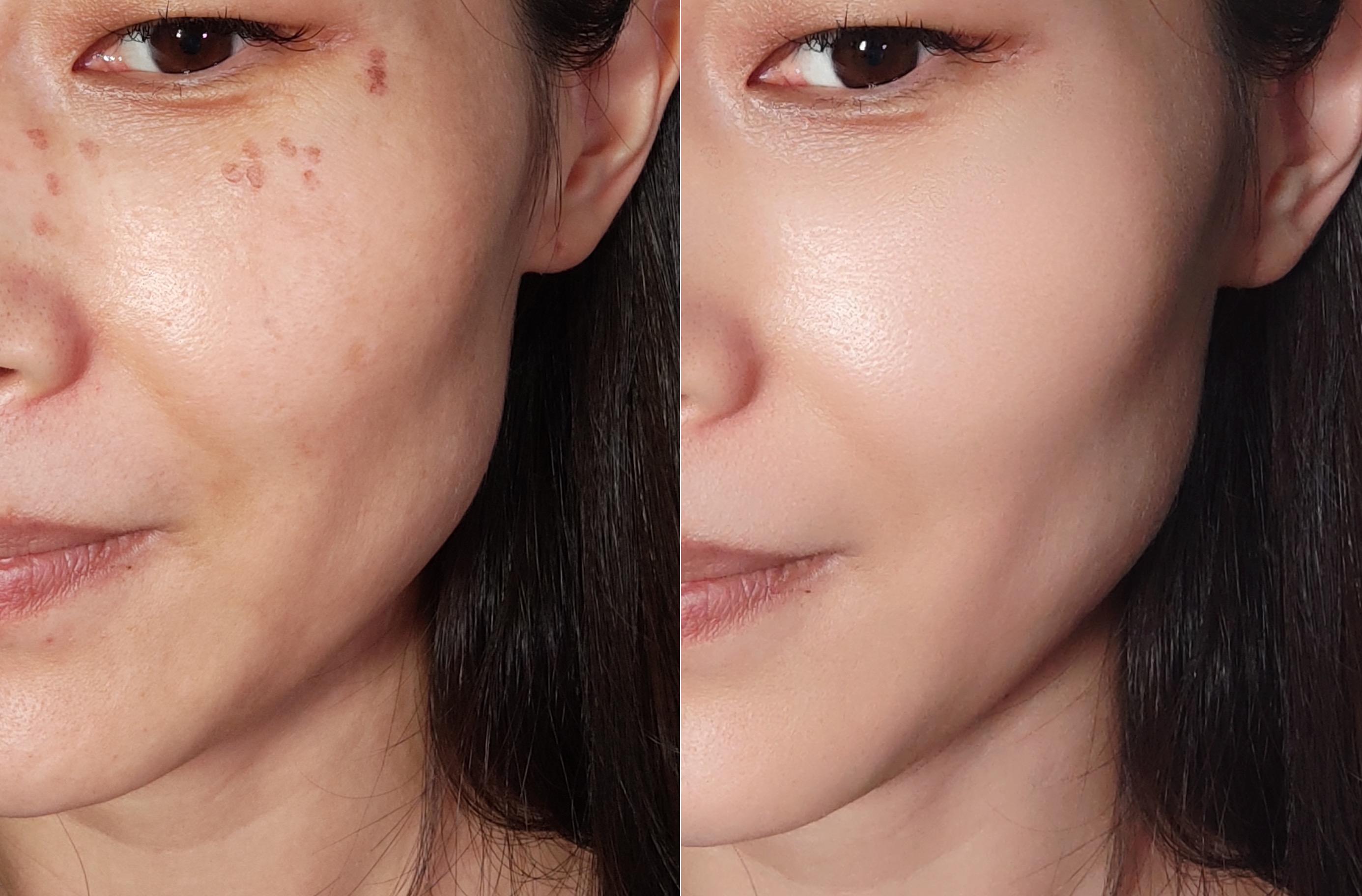 小米Civi自拍效果有多强？知名数码博主晒自拍，痘痘神奇的消失了