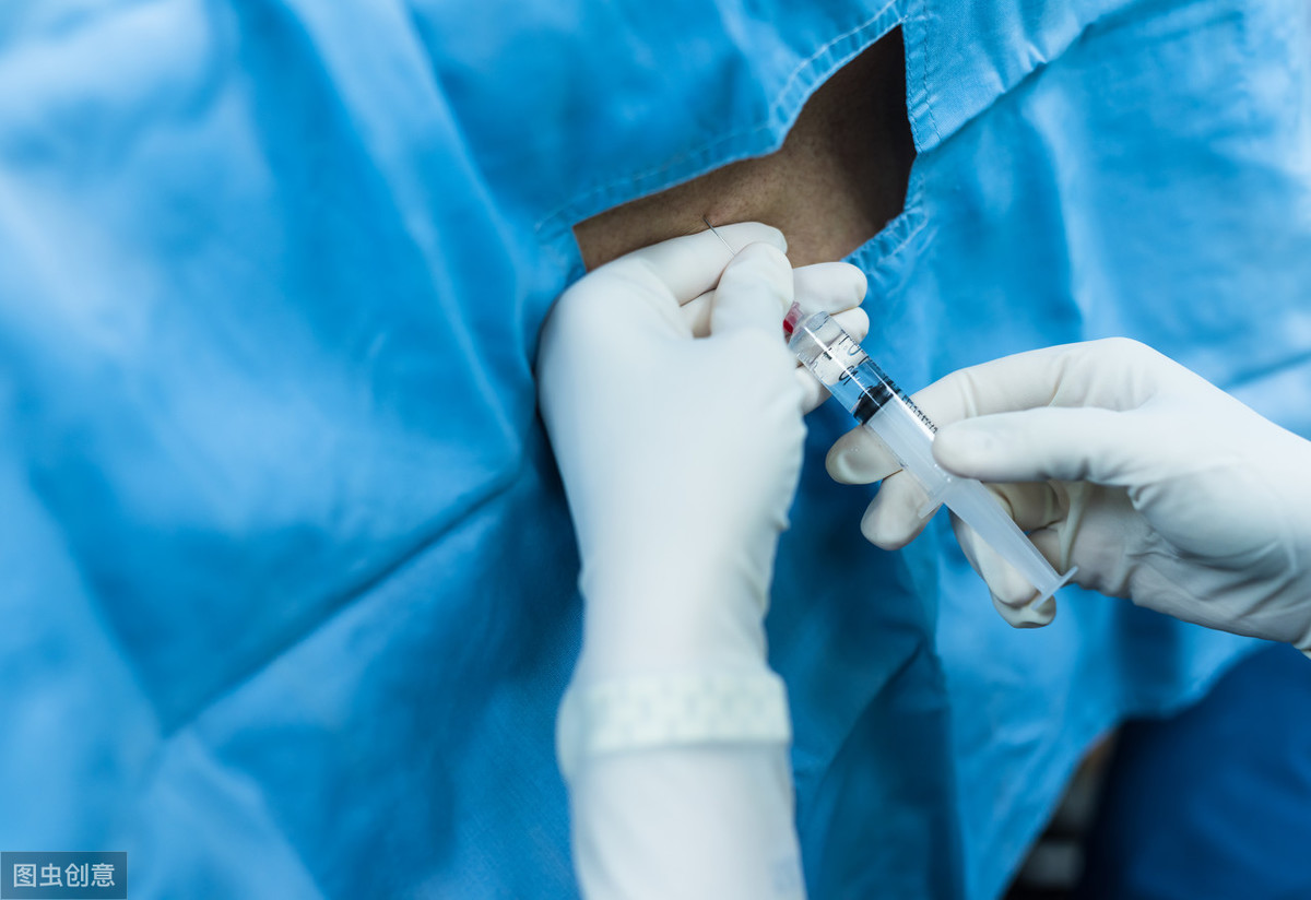 神经阻滞术疗法治疗疼痛彻底吗,星状神经节阻滞术治面瘫一般几次