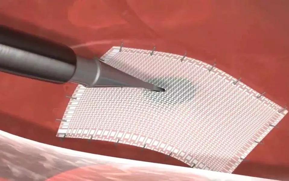 “大爷,你的肠子怎么老往外掉?”