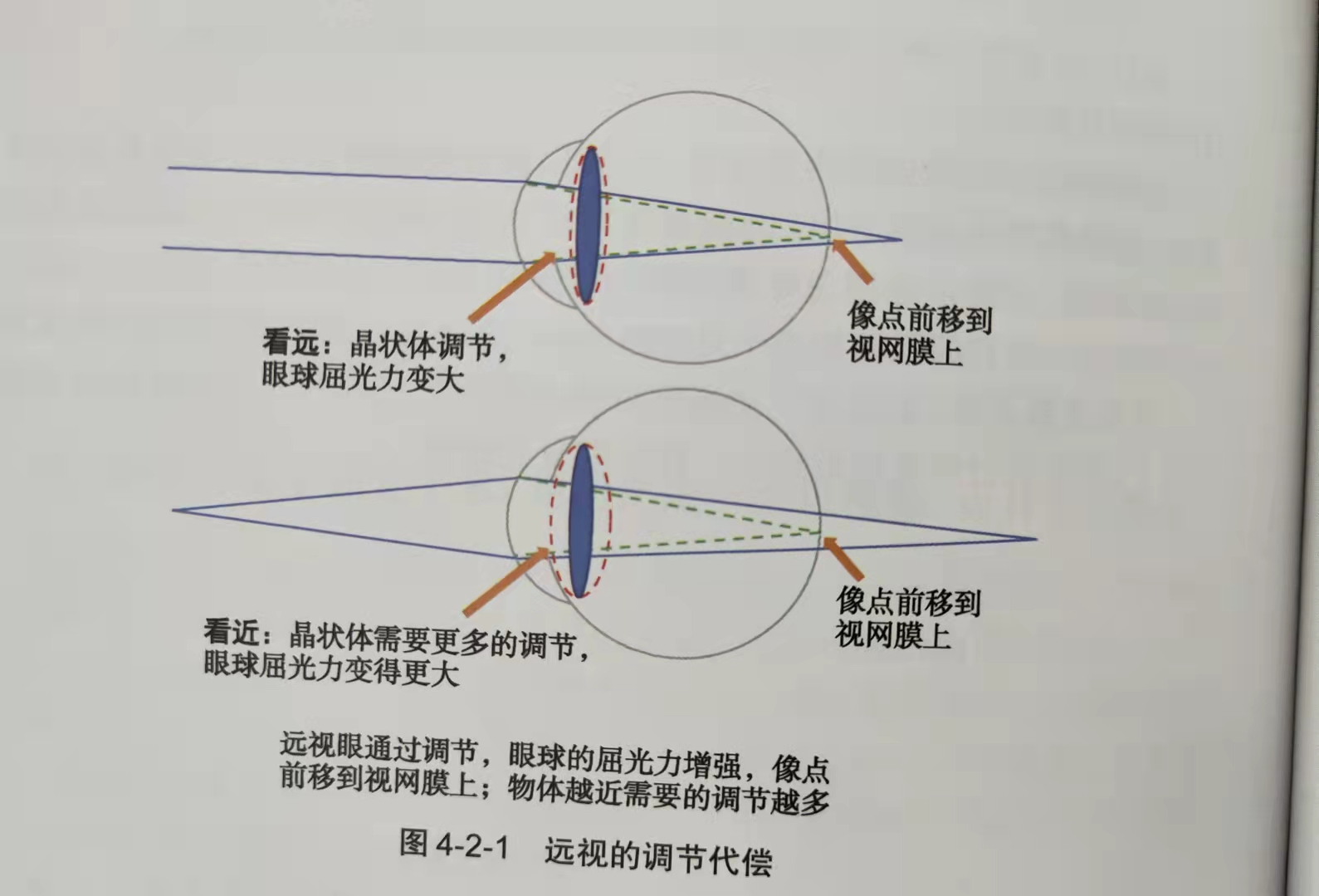 小朋友300度的近视要一直戴眼镜吗,低度近视要不要戴眼镜