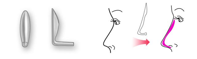 100个最关心的问题,隆鼻的十大问答