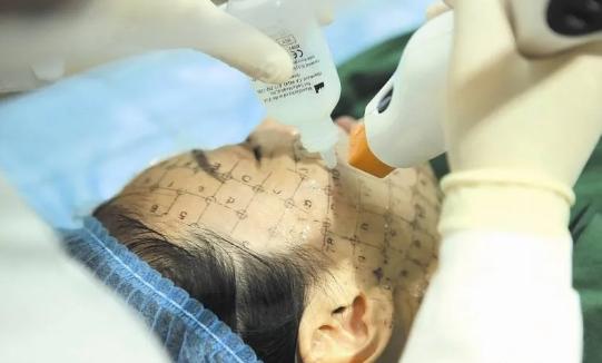 皮肤有斑点暗黄做什么医美项目,便宜又好用的医美项目有哪些