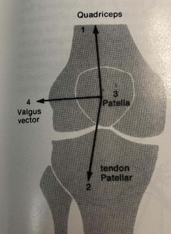 膝盖附近疼是髌骨软化症引起的吗,髌骨膝前疼痛综合症