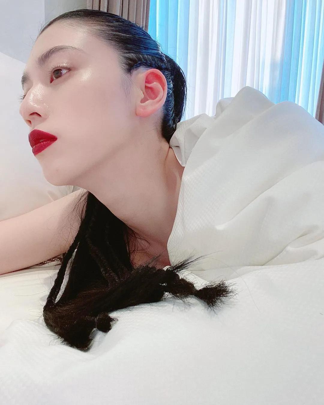 凸嘴怎么自己改善视频,纠正凸嘴后的对比照片