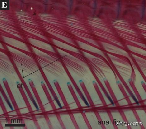 黑眼圈为什么要早睡,黑眼圈的本质是什么