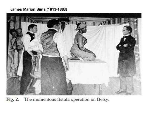 黑奴实验：残忍的手术开辟了妇科治疗，却将伦理道德丢了一地