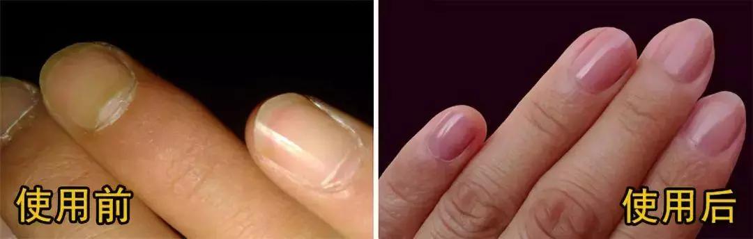 一把合格的指甲刀,一把指甲刀