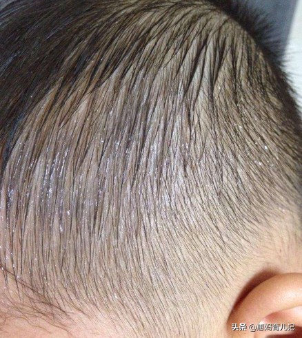 晚上盗汗衣服湿透什么原因,小儿睡觉盗汗啥原因怎么治