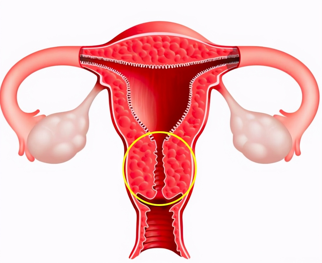 关于宫颈息肉的知识转载,宫颈小息肉是什么病严重吗