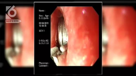 小孩误服化学物质,小孩化学物品吞肚子里怎么办