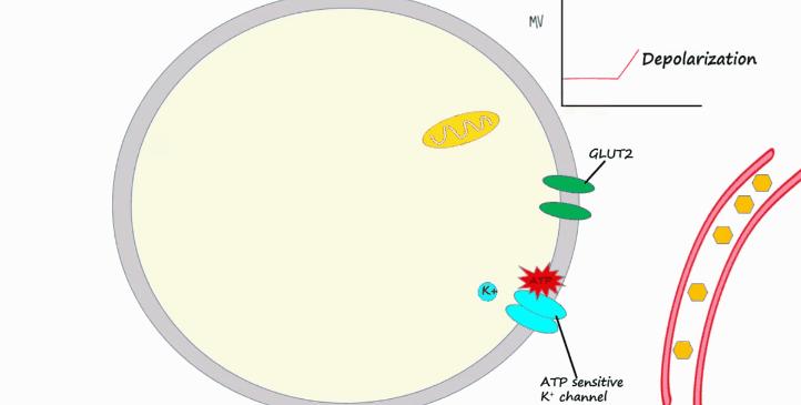 胰岛素是如何导致糖尿病的,胰岛素增多为什么会导致糖尿病