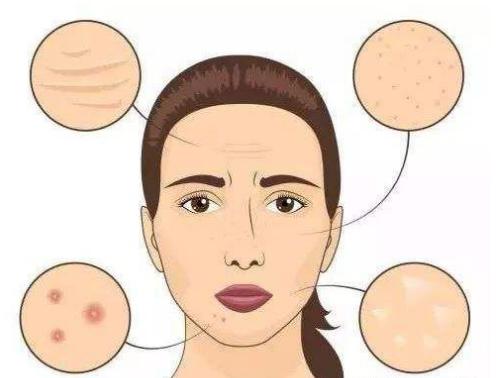 长期对着电脑皮肤怎么护理,对着电脑皮肤会变差吗