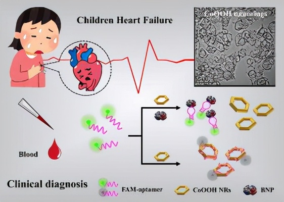 儿童心衰诊断标准及治疗方法,儿童心衰的诊断