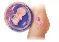 电影中大部分的流产其实都是胎膜早破的现象！