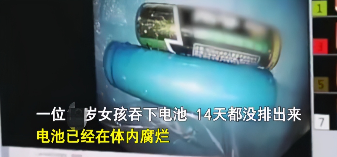 小孩误吞螺丝钉怎么办,二岁小孩误吞螺丝钉几天能拉出来