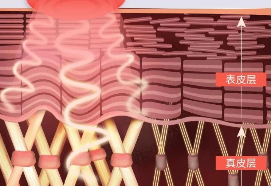 脸上胶原蛋白流失可以打什么针,30岁脸上胶原蛋白开始流失