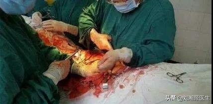 「免疫相关不良妊娠答疑解惑64」——凝血检查及易栓症