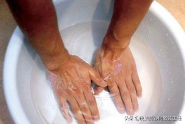 冬天冻疮又痛又痒用什么药喷最好,冻疮又疼又痒怎么缓解