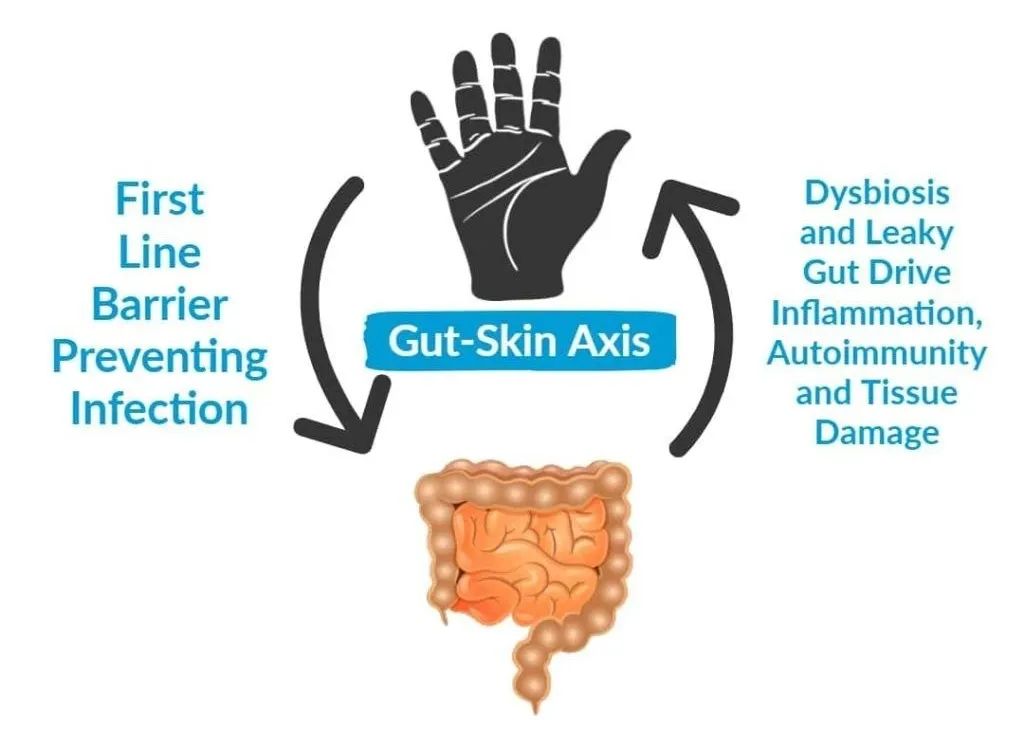 肠道菌群出现问题啥症状,肠道菌群失调会引起哪些皮肤疾病