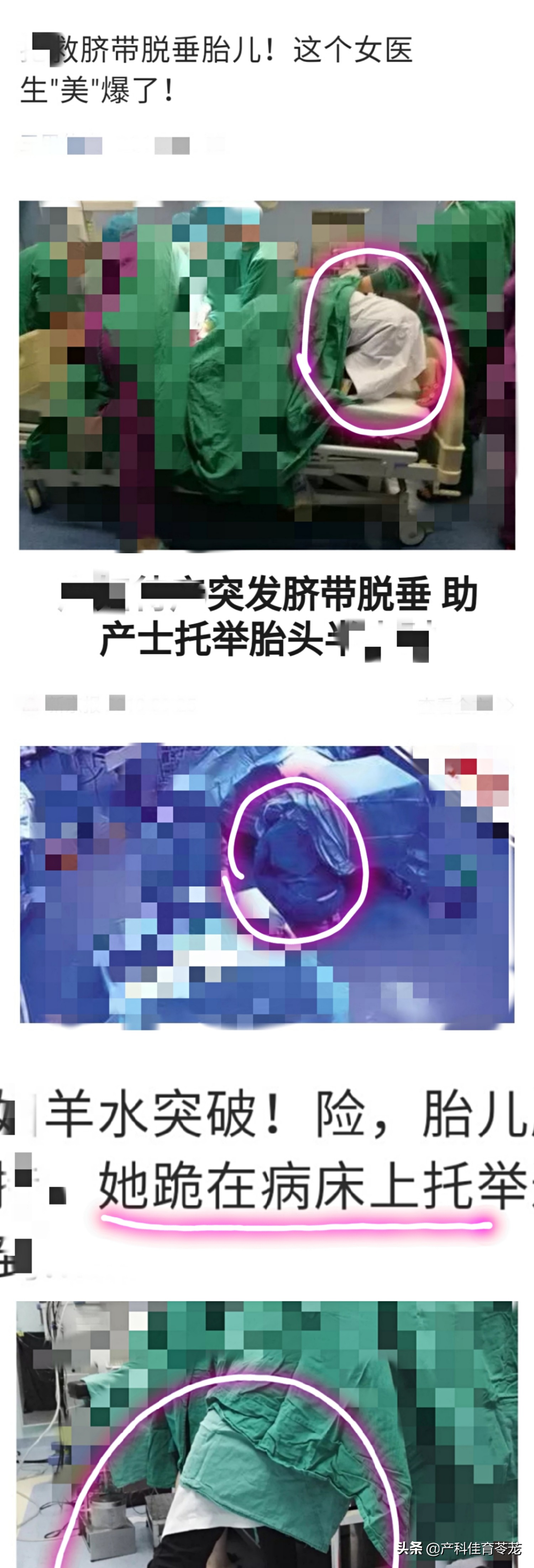 脐带脱垂，破水以后最害怕的事儿