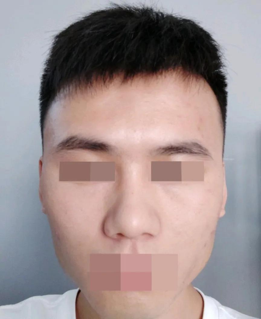 国字脸改变脸型方法,国字脸男怎么能使脸变尖