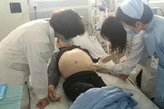 难治性腹水的诊断及治疗,青岛第八人民医院技术怎么样