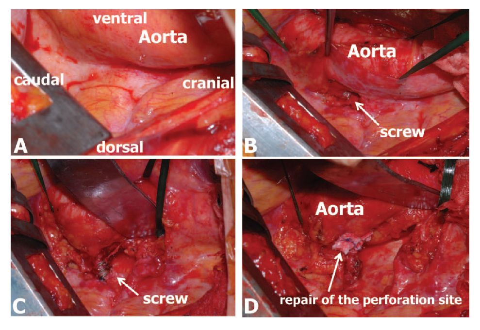 胸椎韧带损伤最佳治疗方法,胸椎损伤与复位