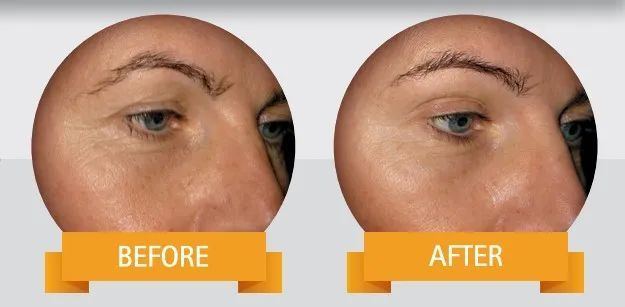 618璐墿,618璐墿鐒﹁檻