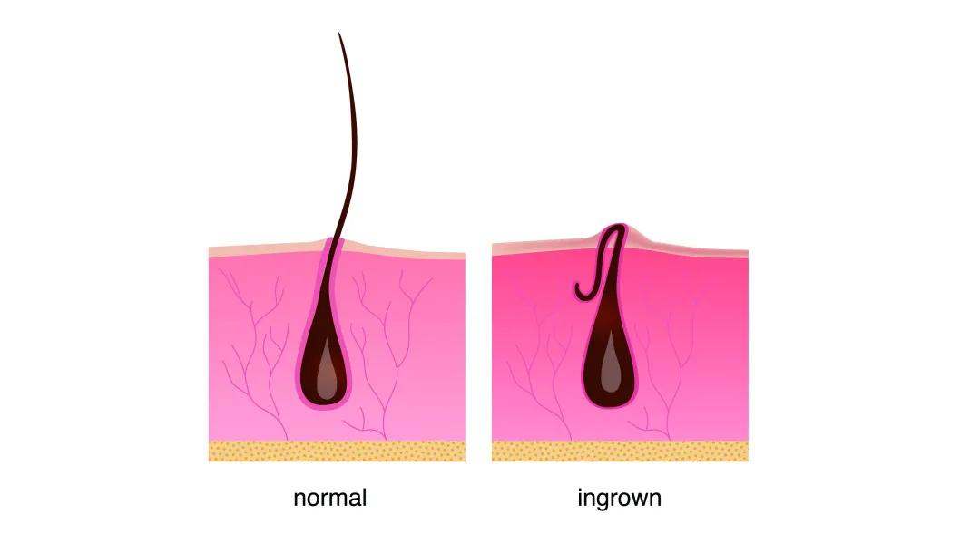 为什么夏天女生喜欢穿热裤,女生为什么大热天穿长袖
