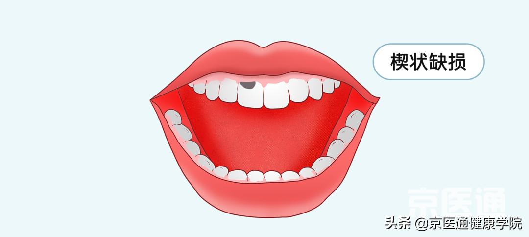 刷牙、剪指甲、滴眼药...这些生活技能很多人都做错了