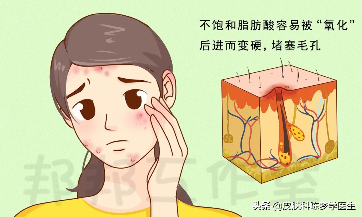 会致痘的化妆品成分,会导致长痘的护肤成分有哪些