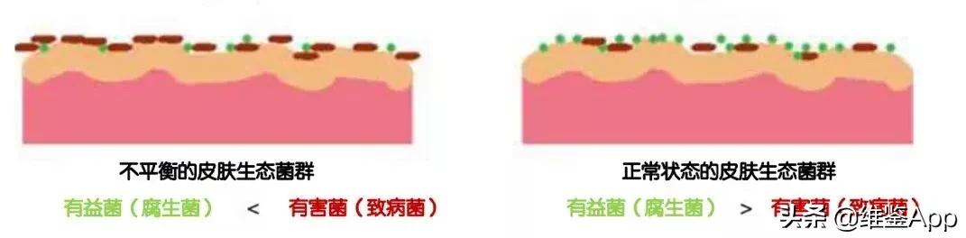 兰蔻小黑瓶出到几代了,兰蔻小黑瓶老款停产了吗