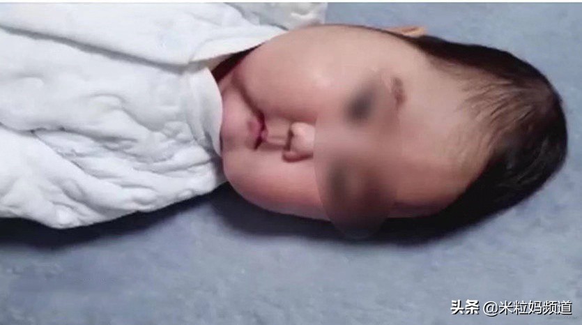 宝宝紫草膏0-6个月,8个月宝宝生长缓慢怎么办