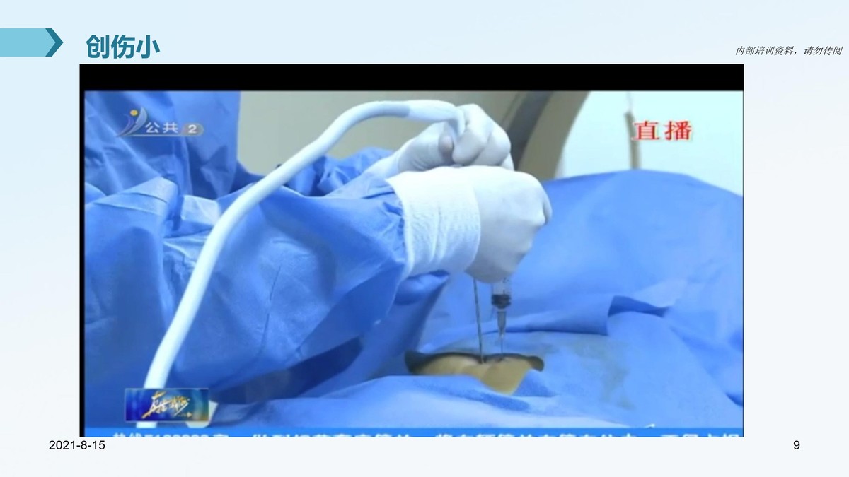 氩氦刀适合早期的肿瘤的切除么,氩氦刀肿瘤治疗新方法