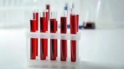 急性胰腺炎引起血淀粉酶升高原因,急性胰腺炎血淀粉酶高是怎么回事