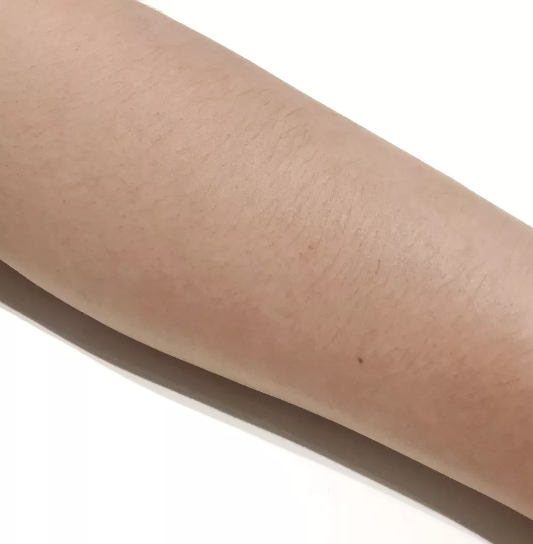 脱毛最好的自然方式,脱毛最好的最安全的办法