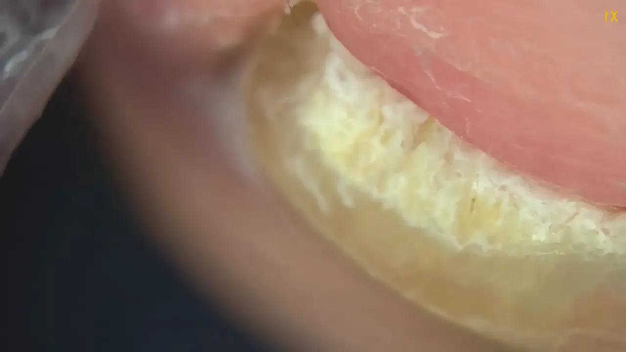 专家教你正确剪指甲的方式,正常指甲怎么修剪为健康