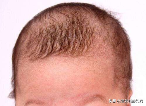 宝宝头发又少又黄要补锌吗,宝宝头发又细又黄还需要剪吗