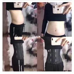 漏尿与内脏下垂,漏尿先天畸形