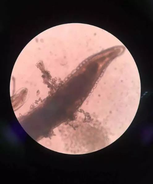 4岁女童屁屁痒,妈妈检查后吓坏了!一粒粒竟还会动...