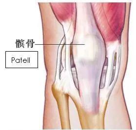 髌骨脱位症怎么治,一篇文章了解髌骨脱位及相关治疗