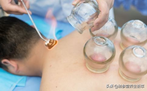 拔罐注意什么多长时间拔一次,自己在家拔罐需要注意什么