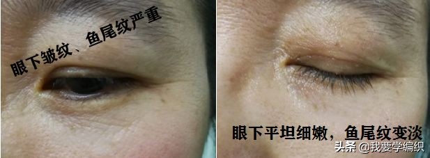 雅诗兰黛眼霜去细纹效果怎么样,雅诗兰黛祛眼纹吗