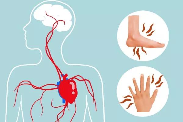 手脚偶尔麻木是什么问题导致的,手脚麻木或是疾病征兆